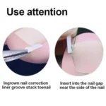 Professional Ingrown Toenail Toolkit Nail Corrector Kit Foot Care Pedicure - Image 5