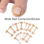 Professional Ingrown Toenail Toolkit Nail Corrector Kit Foot Care Pedicure - Image 8